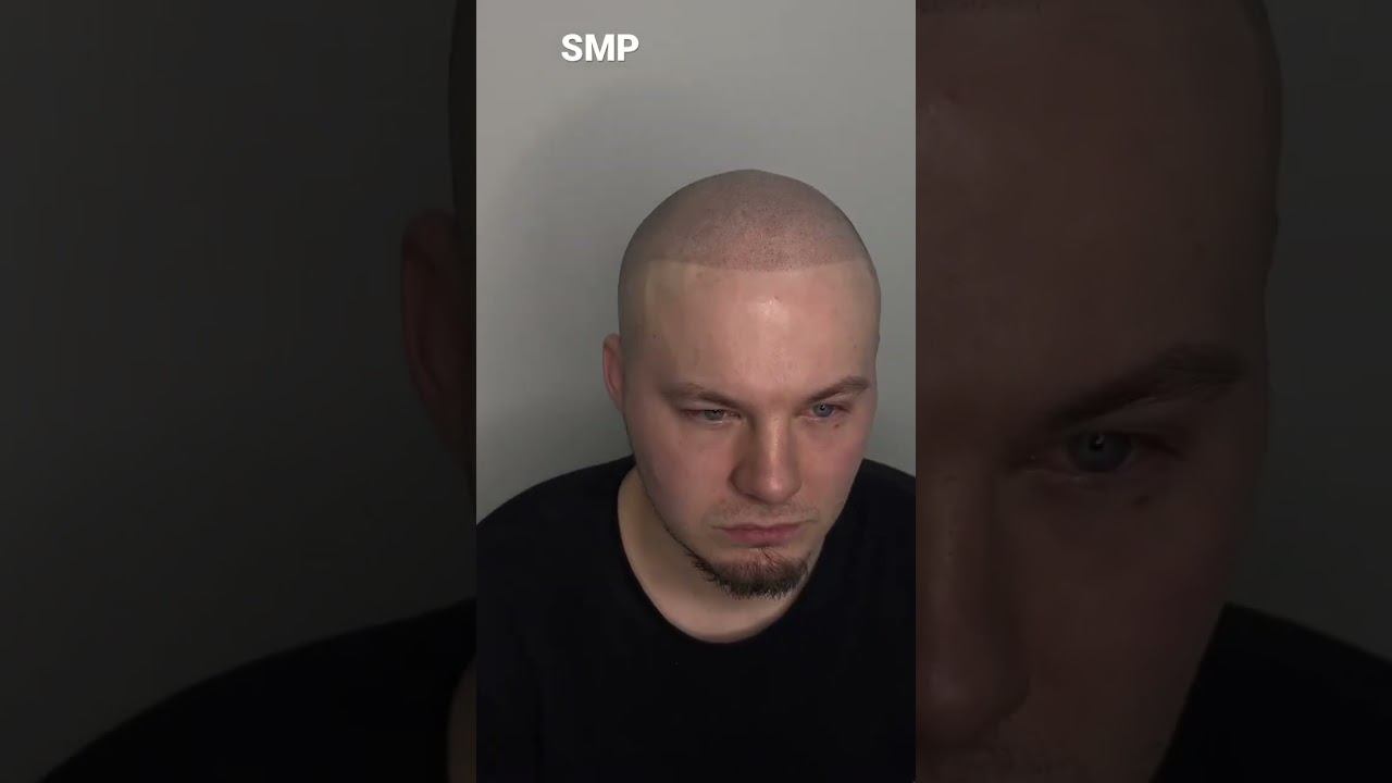 Инновационная трихопигментация