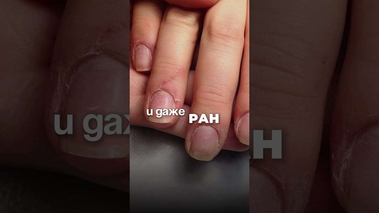 Может быть из-за стресса, тревоги,негативными эмоциями.Нарушением в нейробиологических процессах.