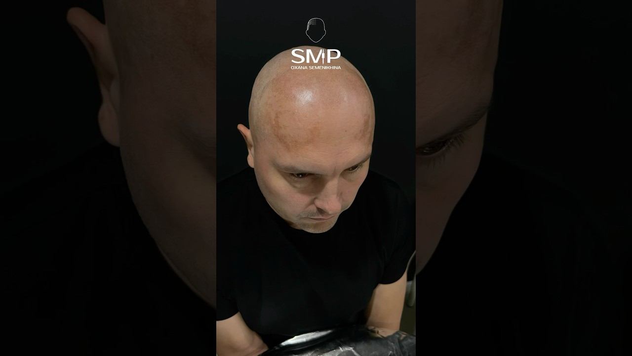 Этапы трихопигментации SMP