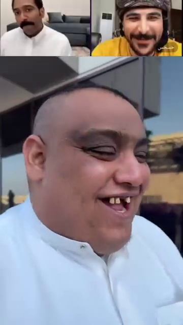 🍟