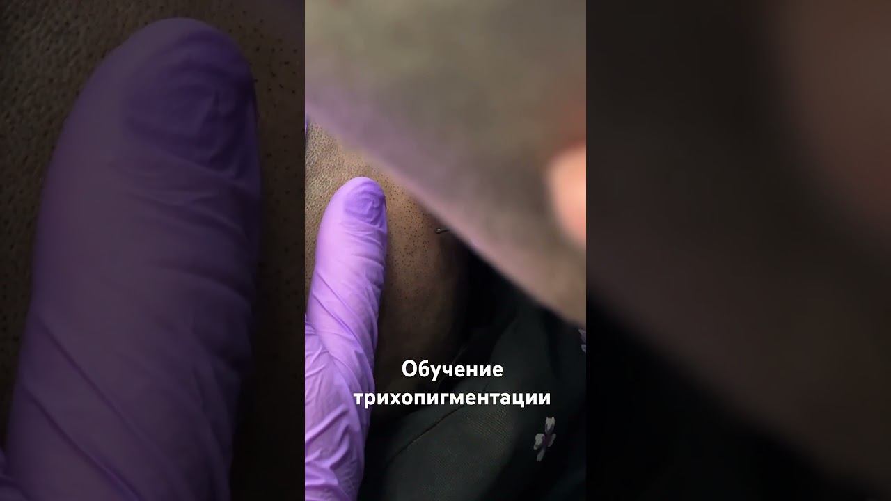 Обучении SMP ( трихопигментация)