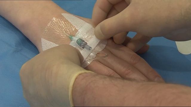 3M™ Tegaderm™ I.V. Advanced Securement Dressing.1681 Application, horizontal strips