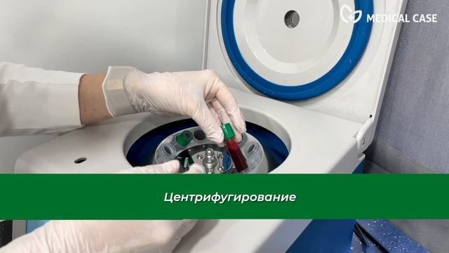 ПОЛУЧЕНИЕ ВИСКОЗНОЙ ФОРМЫ ПЛАЗМЫ