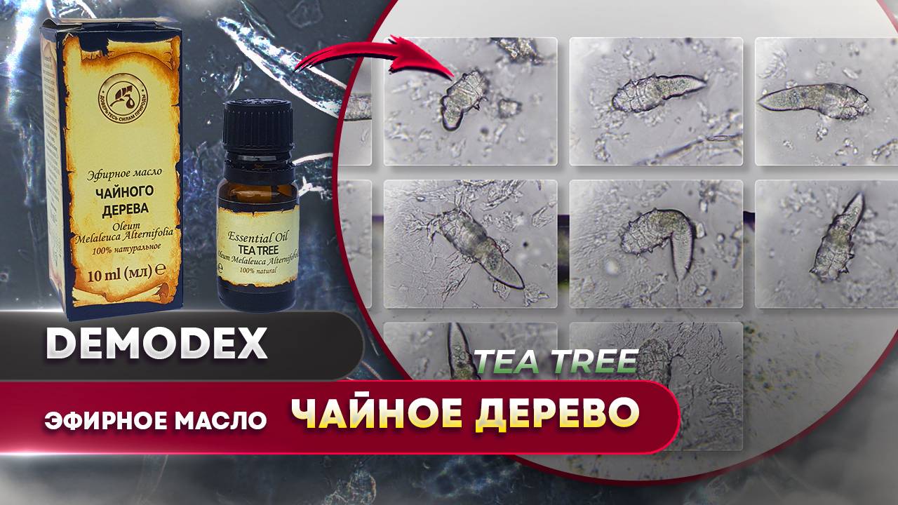 🔥 Эфирное масло чайного дерева vs. клещ Демодекс! Насколько оно эффективно? 🔬