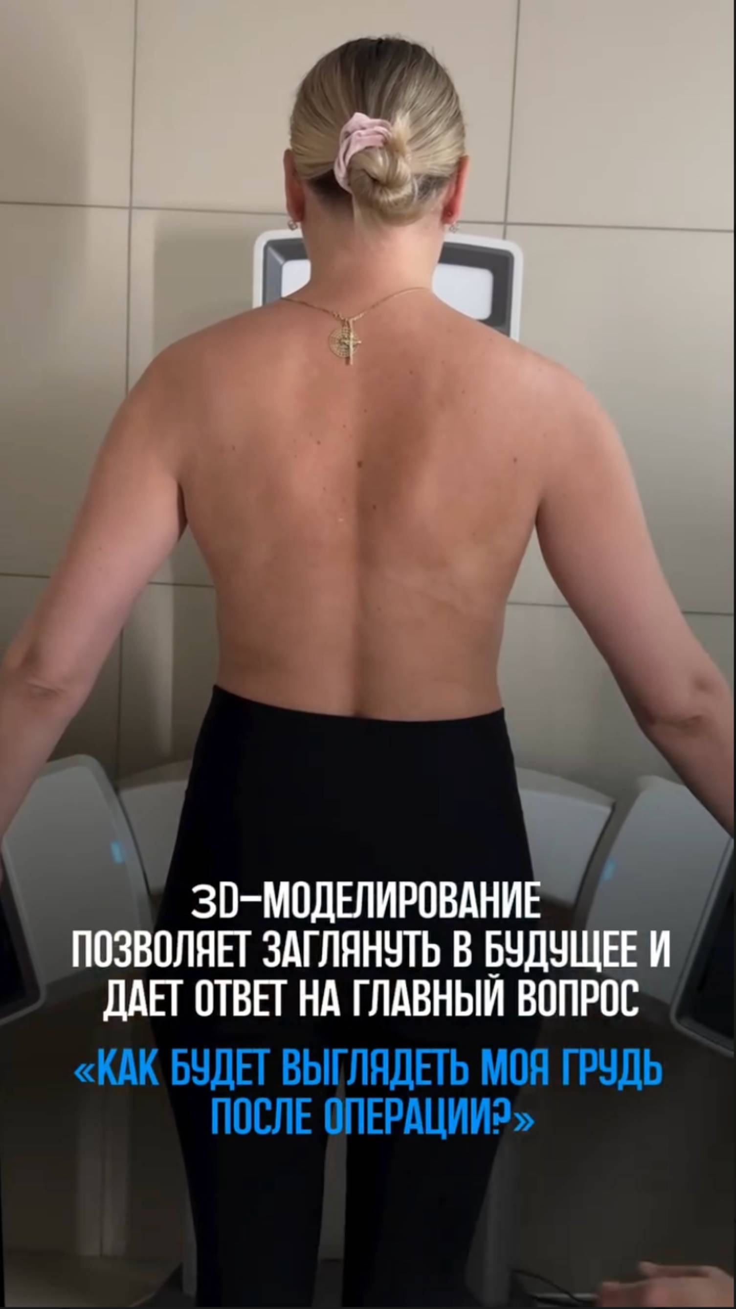 Отвечаю на главный вопрос пациентов: "как будет выглядеть моя грудь после операции?" #пластикагруди