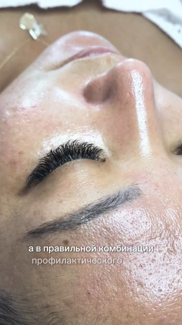 Чистка лица. Работа с акне и пигментацией