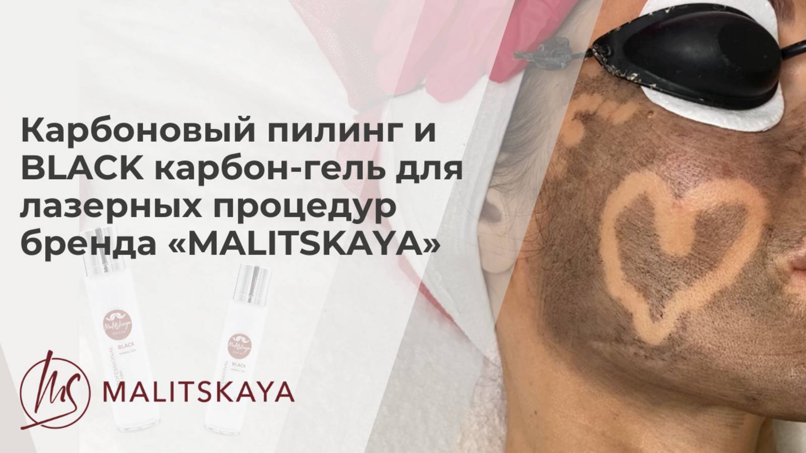 Карбоновый пилинг и BLACK карбон-гель для лазерных процедур бренда «MALITSKAYA»