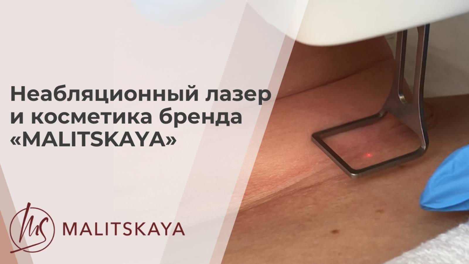 Неабляционный лазер и косметика бренда «MALITSKAYA»