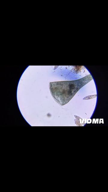инфузория трубач