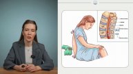 Урок 5.4 Эпидуральная анестезия (ознакомительный фрагмент)