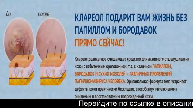 Клареол Купить В Москве