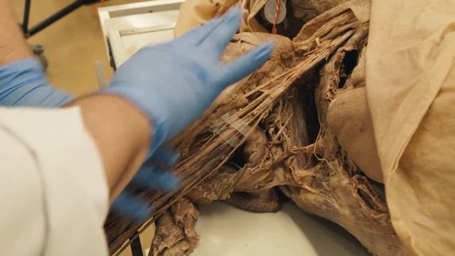 Nerven des Plexus brachialis schnell und einfach finden - Sezierkurs Live Tag 27