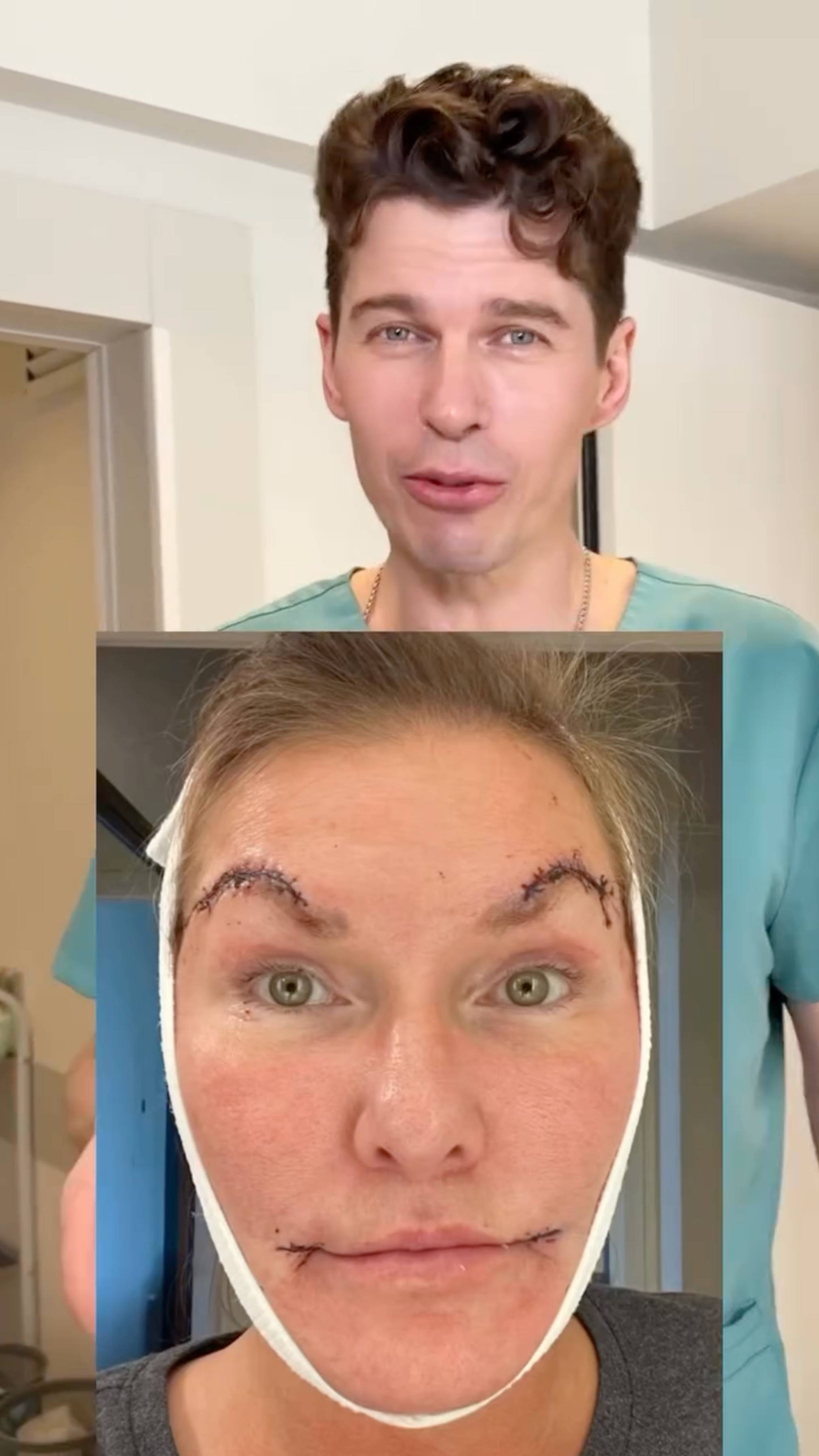 Невидимая подтяжка лица!  #сергейсвиридов #подтяжкалица