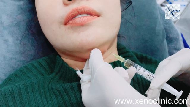 XENO CLINIC MESO FAT NY MONINEATH
