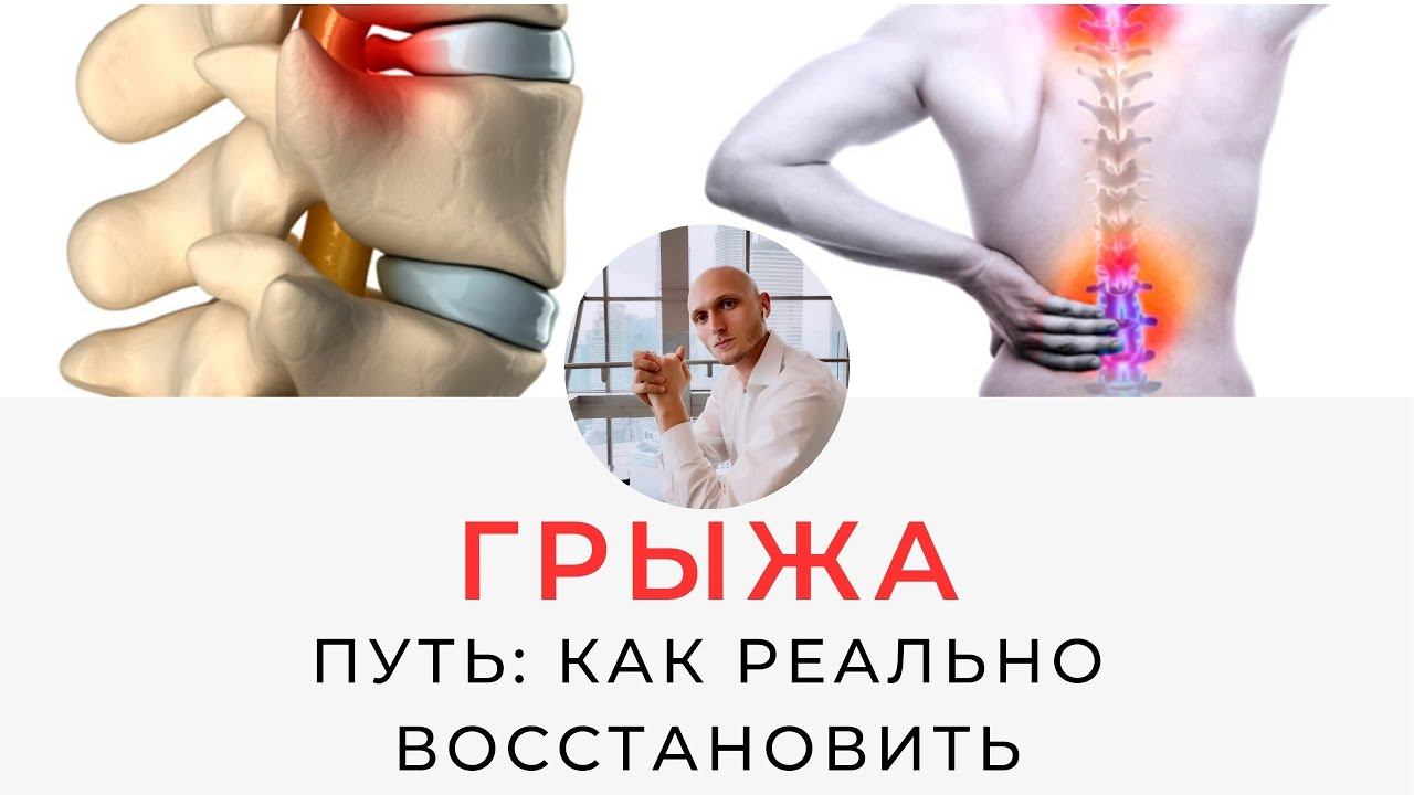 Как вылечить грыжу? Ошибки и стратегия восстановления | Реабилитолог Павел Артемьев