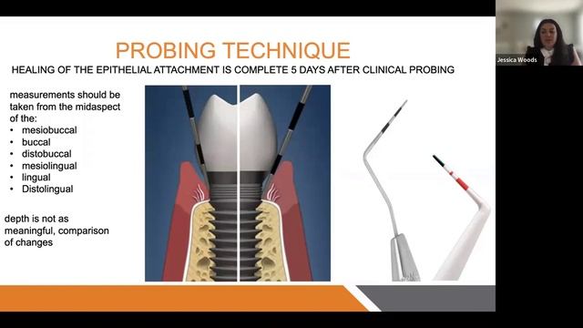 Dental Treatment: Implant Probing | Jun 9, 2022