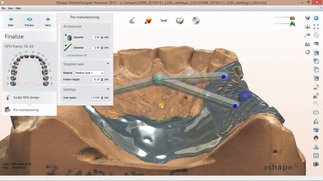 RPD Pre-manufacturing & Finalizing in 3Shape Dental System 2015