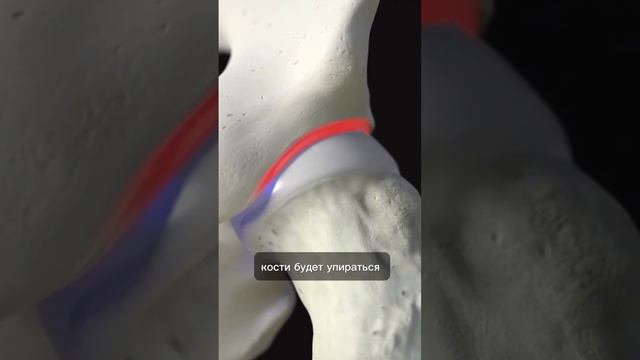 почему не все могут сесть на шпагат?