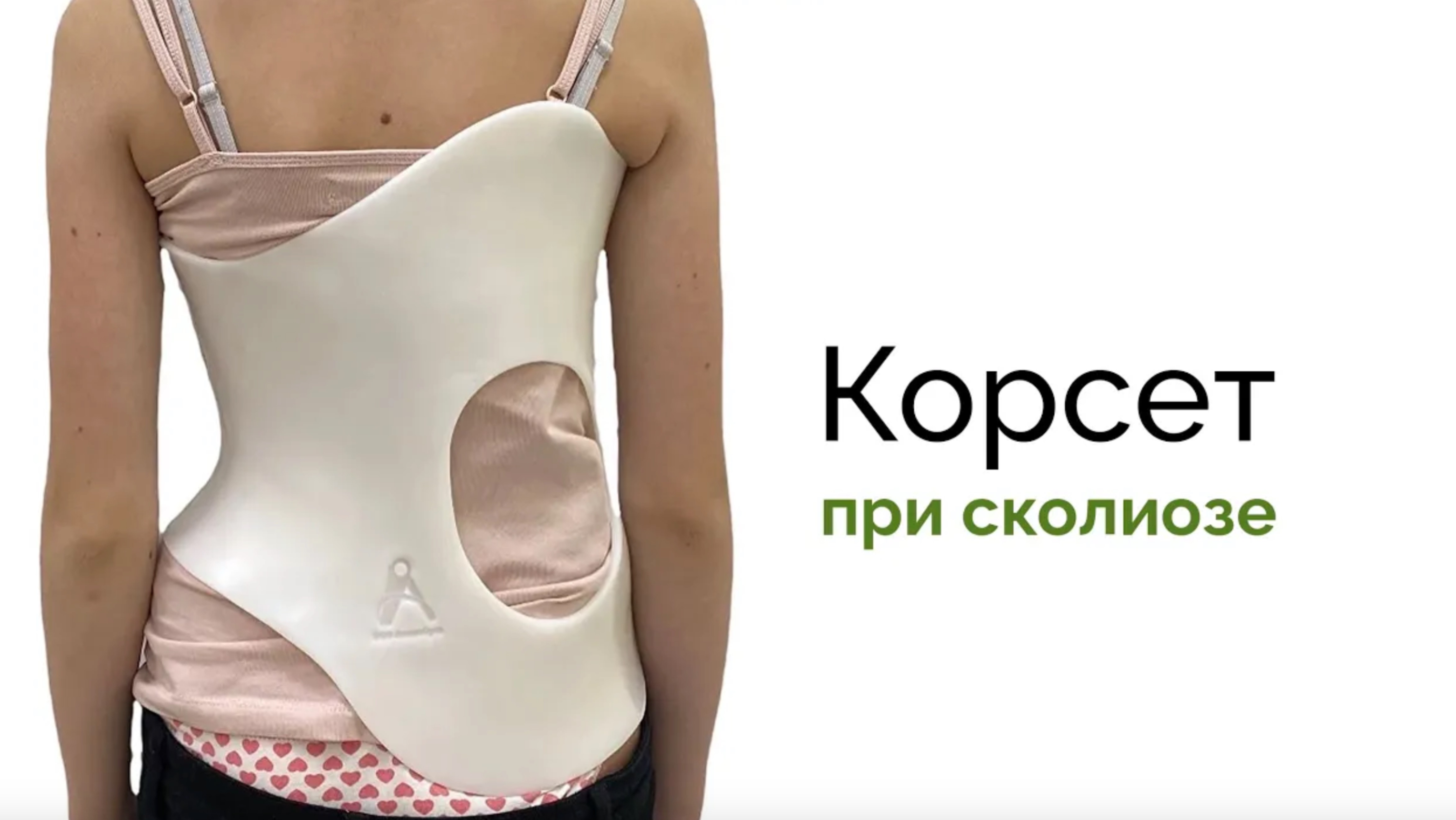 Корсет при сколиозе краткий обзор