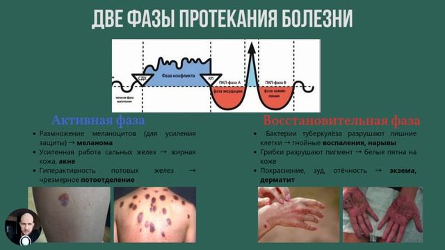 меланома, саркома, прыщи и другие кожные заболевания. как пройти через эти заболевания?