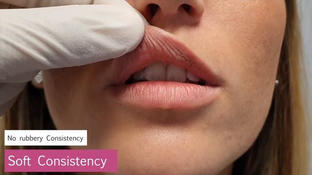 How to resolve Filler complications with Hyaluronidase