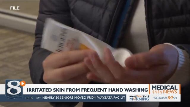 How to clear up irritated skin from frequent hand washing