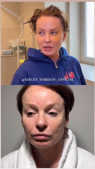 Наша шикарная Жанна Эппле. Невидимая подтяжка лица!  #сергейсвиридов