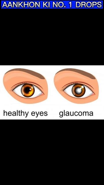 Euphrasia Eye Drop | Best Homoeopathic Medicine For Eye (Conjusctivitis ,Cataract, Glaucoma, Pain )