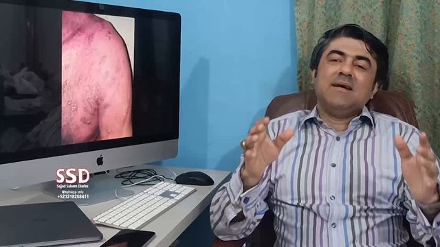 SSD 477Jinnaat ki sakht saza.7 pain killer injections ne bhi kaam na kiya, doctors heraan o paresha