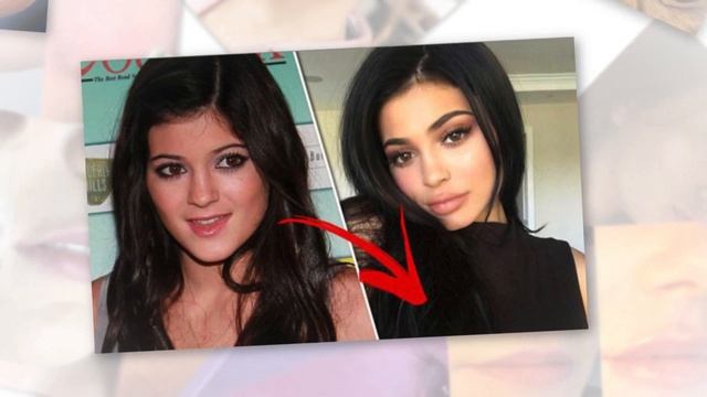 Kylie Package - Transform Your Self