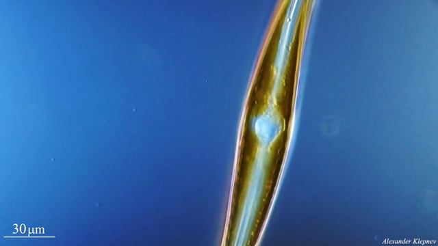 Diatom