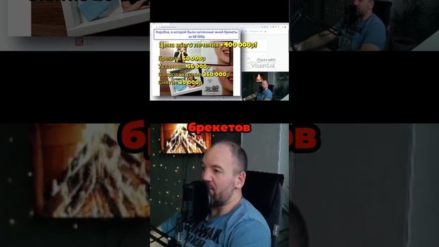 Сколько стоят брекеты и лечение_