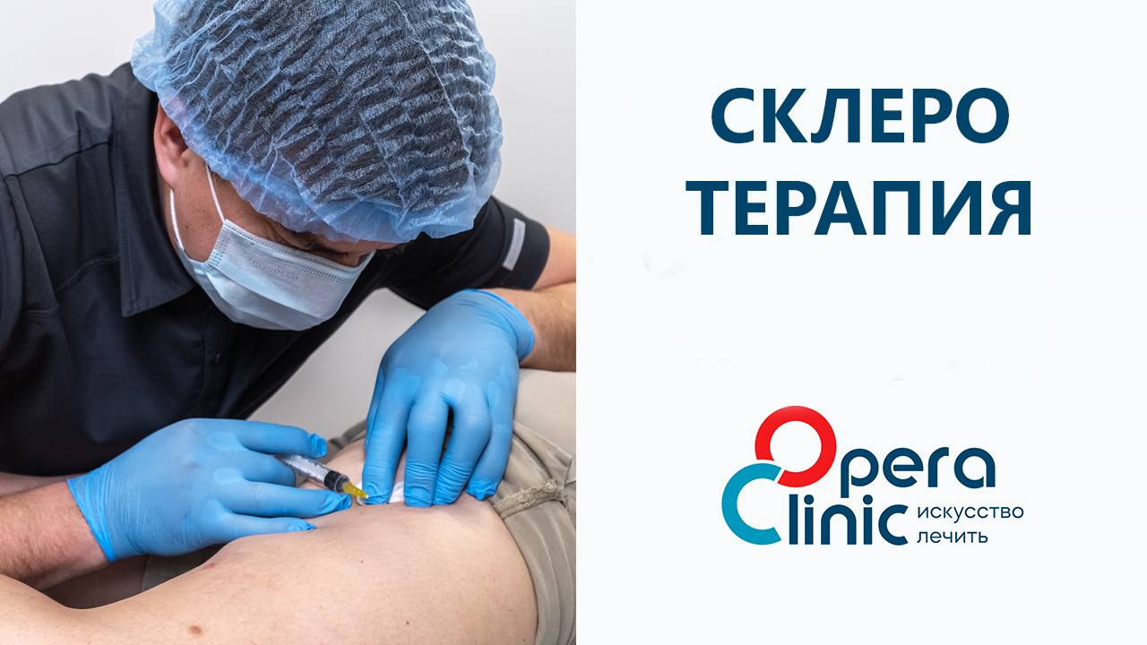 Склеротерапия