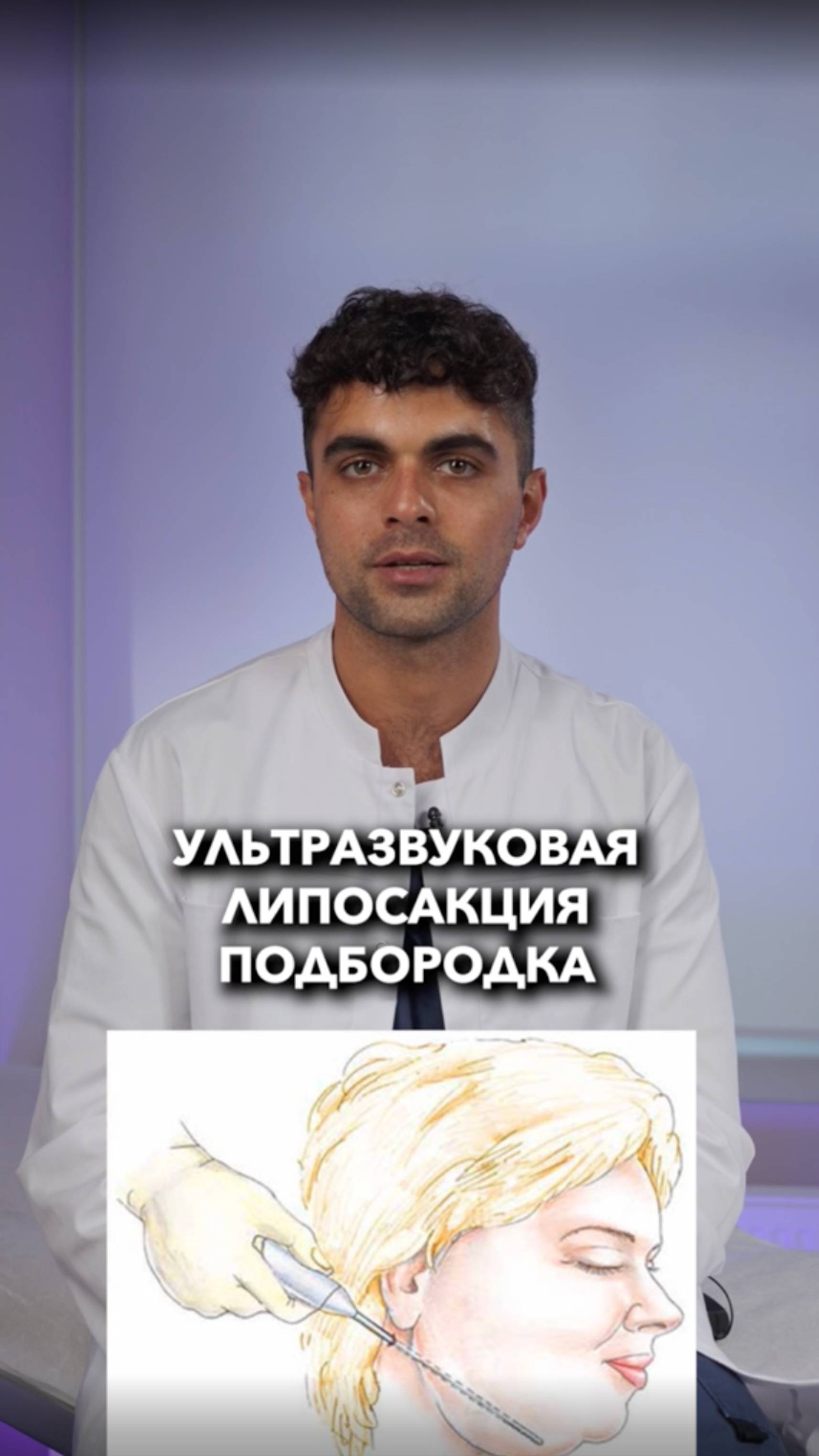 Ультразвуковая липосакция подбородка - маленькая операция, с большим эффектом!   #шонцион