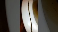 5 foot long Parasite WORMs that came out of my Body!