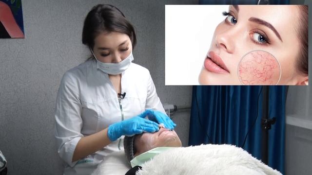 Косметолог бетке туура кам көрүүнүн сырлары менен бөлүшөт