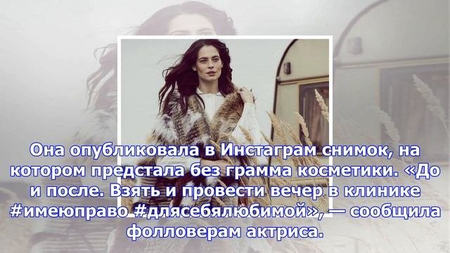 Юлия снигирь поделилась снимком, сделанным после похода к косметологу
