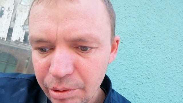 Рассеянный склероз. Результаты МРТ.