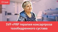 SVF+PRP терапия коксартроза тазобедренного сустава