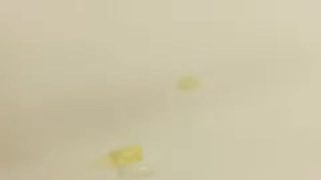 RelyX Unicem 2 Self-Adhesive Resin Cement