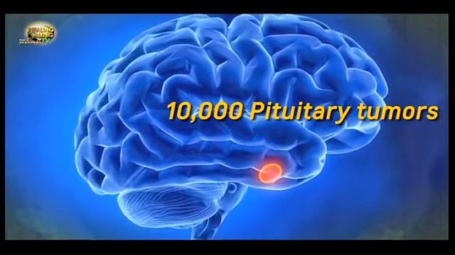 Healing Galing SO10EP10 Pituitary Tumor pt1