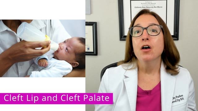 Cleft Lip & Cleft Palate: Pediatrics  - Alterations in Health | @LevelUpRN