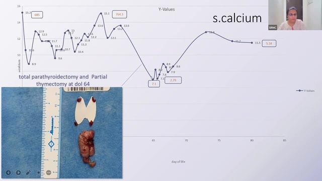 Neonatal Hyperparathyroidism
