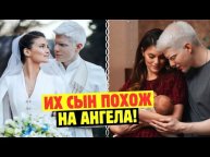 Самый Известный В Мире Альбинос И Его Жена Показали Своего Сына