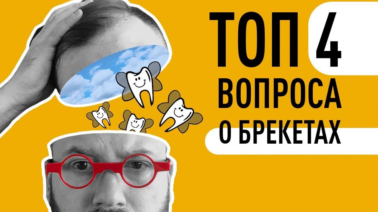 Топ 4 вопроса о брекетах