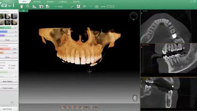 Pax-i 3D - панорамный аппарат с функцией компьютерного томографа