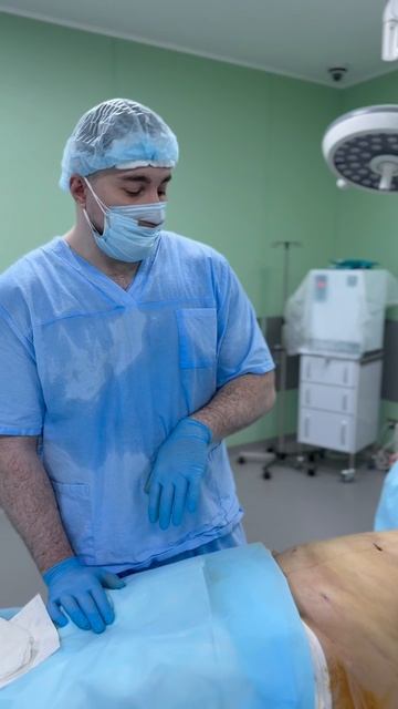 Липосакция живота и боков - результат пластической операции сразу на операционном столе