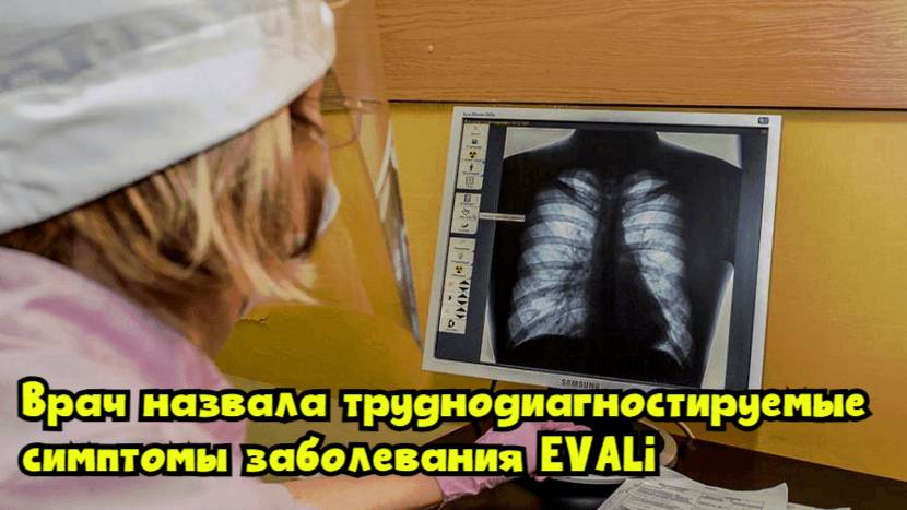 Врач назвала труднодиагностируемые симптомы заболевания EVALI