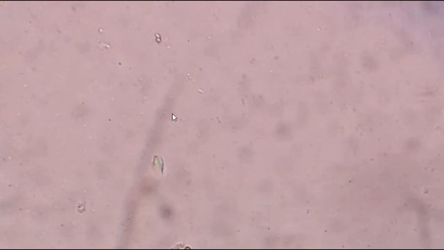 Darting motility of bacteria Positive ||Vibrio cholerae ||Campylobacter jejuni