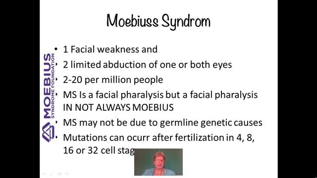 Thanks to all the doctors that reseach about Moebius syndrome
